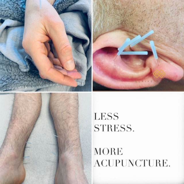 Less Stress More Acupuncture